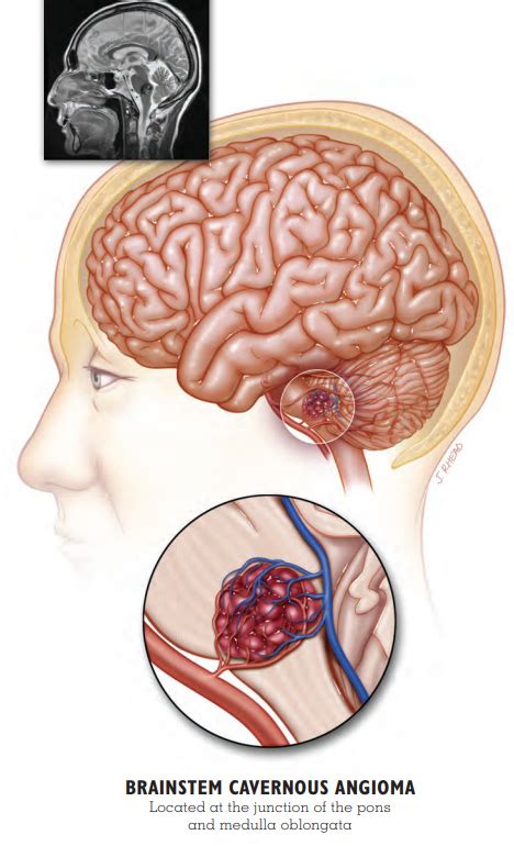 Brainstem Function And Location