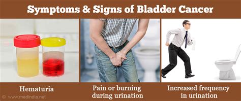 Bladder Cancer – Symptoms, Signs, Diagnosis, Treatment, Prognosis & Prevention