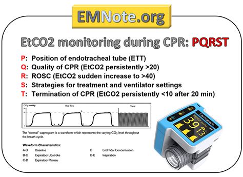 EMNote.org - EMNote