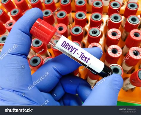 Blood Sample Drvvtdiluted Russell Viper Venom Stock Photo 2230665163 | Shutterstock