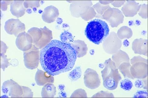 Sigma Diagnostics Wright Stain, Modified:Biochemical Reagents:Staining ...