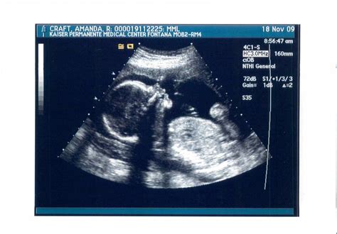 the craftys: 22 Weeks and another Ultrasound!