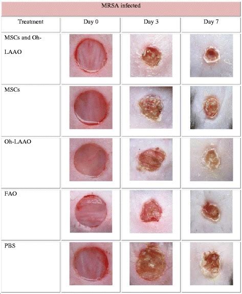 37 Best Photos Cat Wound Healing Stages Pictures : The Good Health Room | The 3 Phases of Wound ...