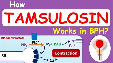 How Tamsulosin (Flomax) works in BPH ? - YouTube