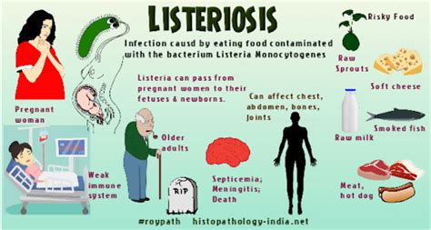 Listeriosis Causes, Symptoms, Treatment - UPSC Notes | Testbook.com