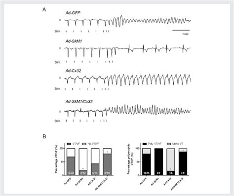 Incidence and phenotype of induced VT. (A) Typical examples of the... | Download Scientific Diagram