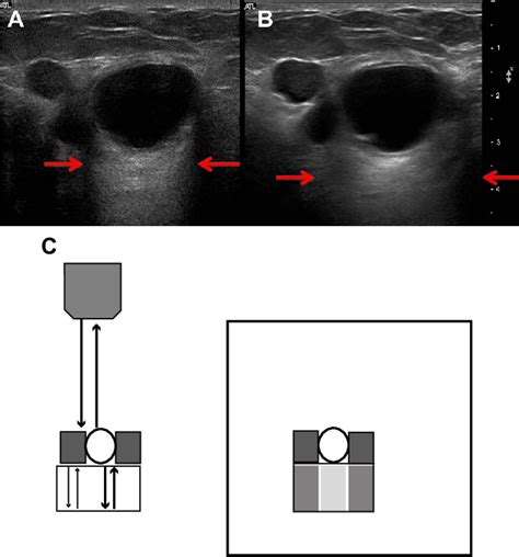 [PDF] Artifacts in diagnostic ultrasound | Semantic Scholar