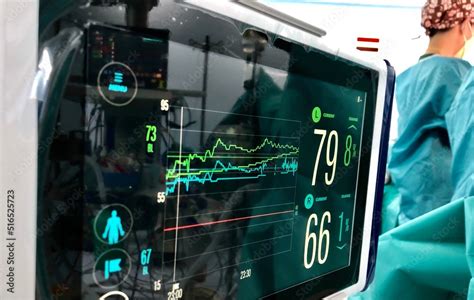 Near-infrared spectroscopy (NIRS) monitoring during open heart surgery. Stock Photo | Adobe Stock