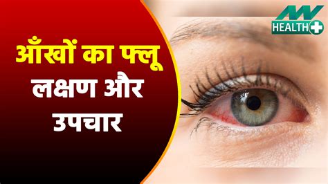 Eye flu: symptoms and treatment - News Nation English