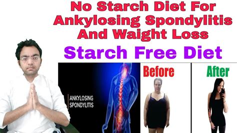 No Starch Diet For Ankylosing Spondylitis & Waight Loss Patients - YouTube