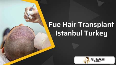 FUE Hair Transplant Istanbul Turkey | Asli Tarcan Clinic