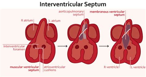 interventricular-septum2 - www.medicoapps.org