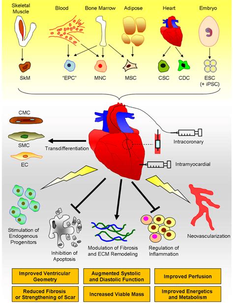 Stem Cell Therapy for Heart Failure: cell types, delivery methods,... | Download Scientific Diagram