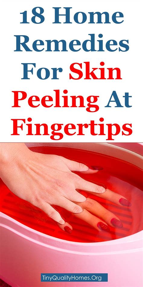 18 Home Remedies To Get Rid Of Skin Peeling At Fingertips (With images ...