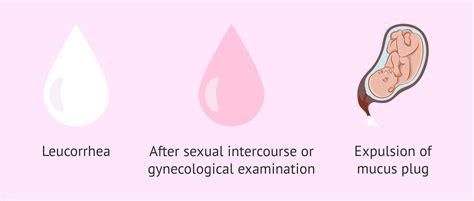 Is it normal to have vaginal discharge, what is it for and when is it ...