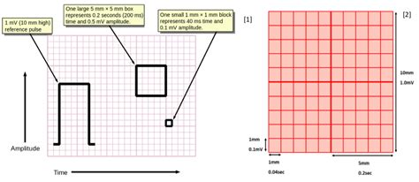 ECG Basics - Mind The Bleep