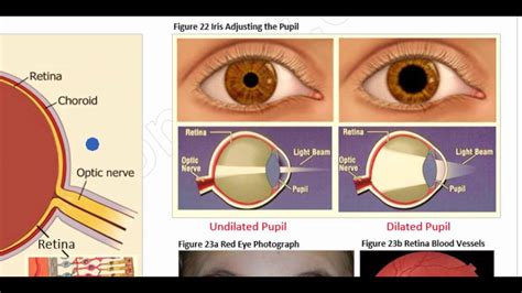 Understanding Eye Anatomy Vitreous Humor Function