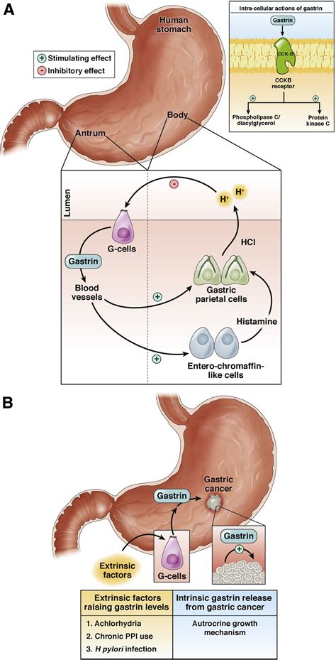 Gastrin and Gastric Cancer - Cellular and Molecular Gastroenterology ...