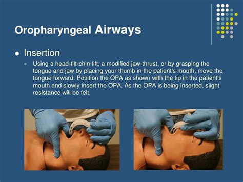 PPT - Airway Management Part I PowerPoint Presentation, free download ...