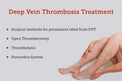 Deep Vein Thrombosis, DVT Symptoms, Causes And, 59% OFF