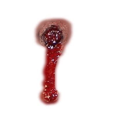 Bullet Wound transparent PNG - StickPNG