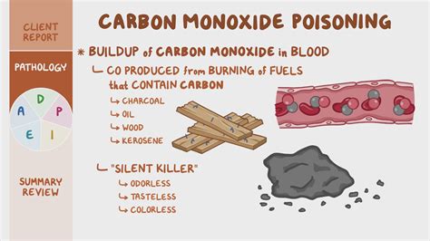 Carbon Monoxide Poisoning