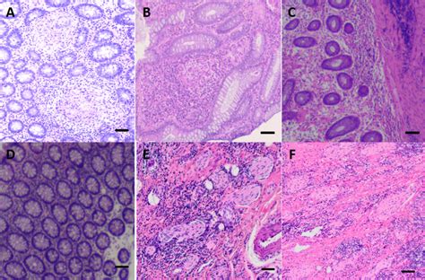 Intestinal mucosal histology and pathology (Histological images of ...