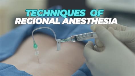 Regional Anesthesia | Techniques - YouTube