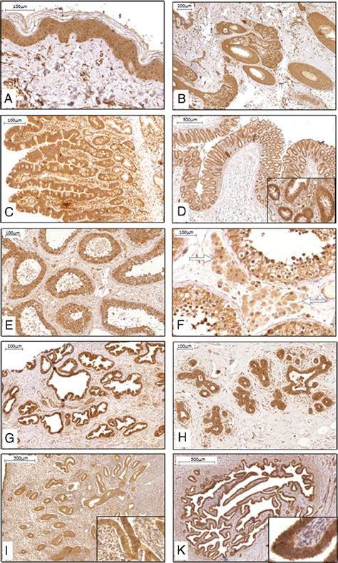 Klotho protein expression and distribution in human epithelial and ...