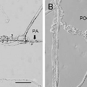 Mycoparasitic interactions between A: Pythium oligandrum (PO) and P.... | Download Scientific ...