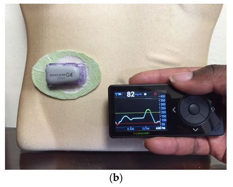 Kinesiology & Sport Review: Constant Glucose Monitor