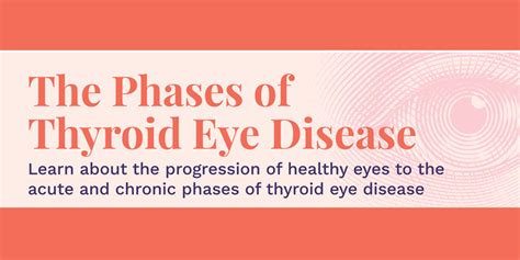 The Phases of Thyroid Eye Disease - HealthyWomen