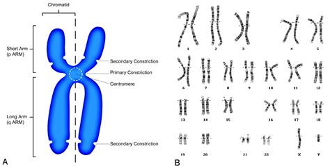 schematic human chromosome : Biological Science Picture Directory ...