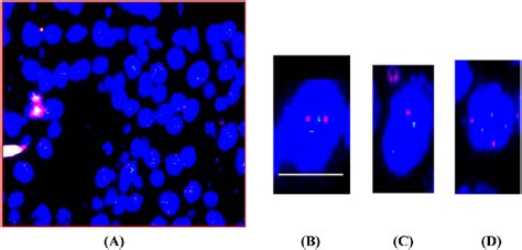 Representative FISH images (chromosome 1, analogous signals are ...