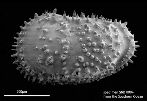 Real Monstrosities: Ostracod