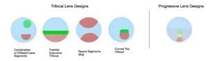 Progressive Lenses Vs Trifocal Lenses – Difference Explained