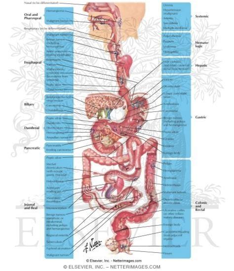 Gastrointestinal Hemorrhage