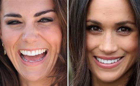 Kate and Meghan's Smiles - The Smile Team | Complete Family and ...