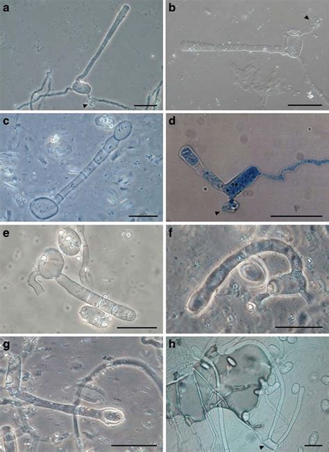 Microcyclic conidiogenesis (MC) in germinated conidia of seven powdery... | Download Scientific ...