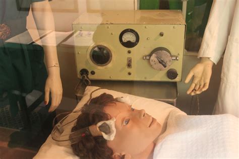 Electroshock - electroconvulsive therapy | General center | SteadyHealth.com