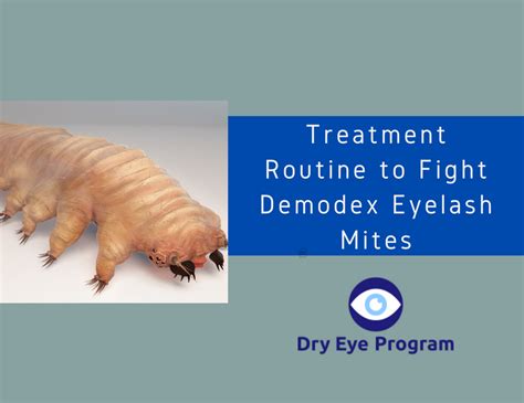 Demodex Eyelash Mites - Complete Treatment Guide to Get Rid of, & Prevent Demodex Eyelash Bugs