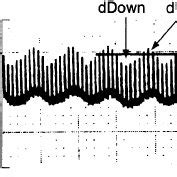 Arterial pressure (AP) waveform analysis. The horizontal line indicates... | Download Scientific ...