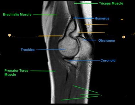 MRI Protocols: ELBOW MRI ANATOMY