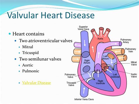 PPT - Valvular Heart Disease Cardiomyopathy and Aneursyms PowerPoint Presentation - ID:4501126