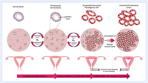 [PDF] New concepts for an old problem: the diagnosis of endometrial hyperplasia | Semantic Scholar