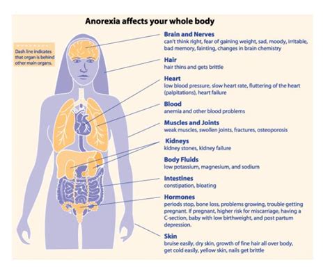 Anorexia Diagram – Anorexia affects your – Ygraph