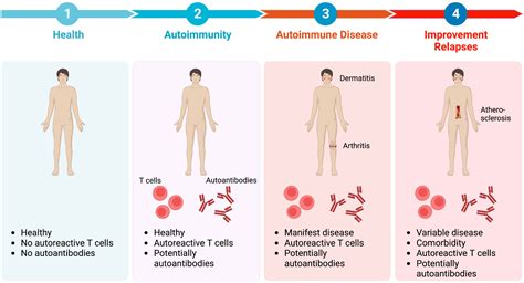 Autoimmune Disease- Definition, Types, And Examples, 47% OFF