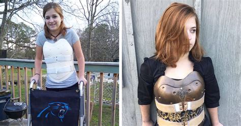 Car Crash Survivor Turns Her Back Brace Into Something Fun