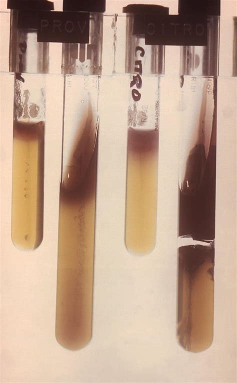 Motility Test -Methods, Procedures and Importance – howMed