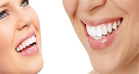 Five tips for preserving naturally white teeth | Eastern Slope Dental